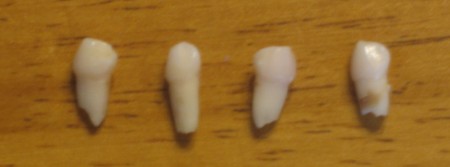teeth.jpg